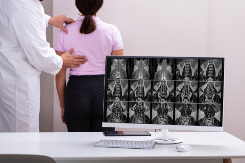 Can a Chiropractor Fix Posture?
