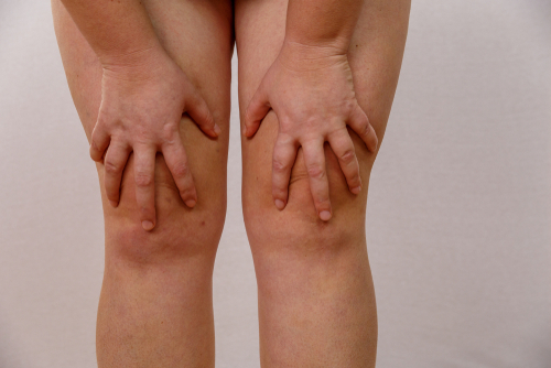 Can A Chiropractor Fix Leg Length?