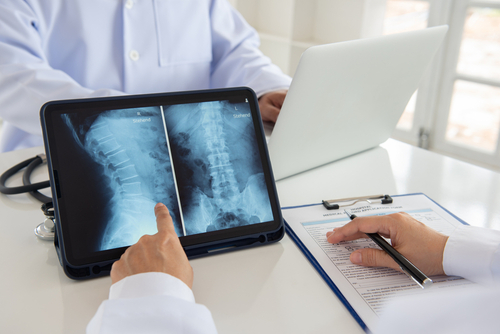 How Chiropractors Diagnose and Treat Common Spinal Issues
